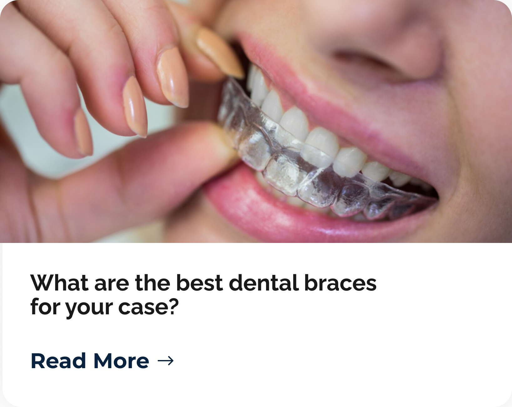 ART-03